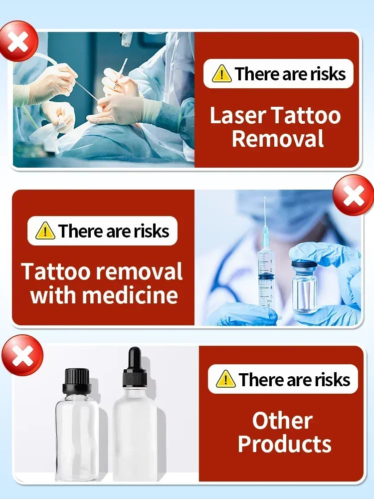 Tattoo Removal Essential Oil, Suitable for Large and Small Tattoos, Effectively Removes Permanent Tattoos