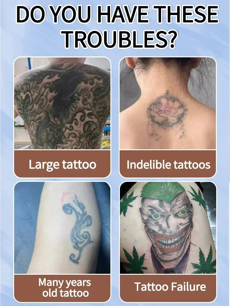 Tattoo Removal Essential Oil, Suitable for Large and Small Tattoos, Effectively Removes Permanent Tattoos