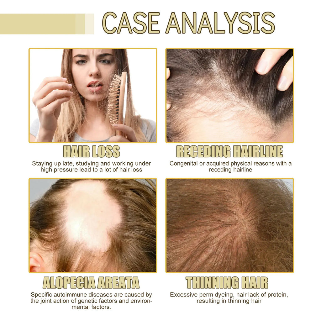 Hair Growth Serum Dense Regrowth Baldness Repair Preventing Hair Loss Nourishing Smoothing Split Ends Fast Growing Essential Oil