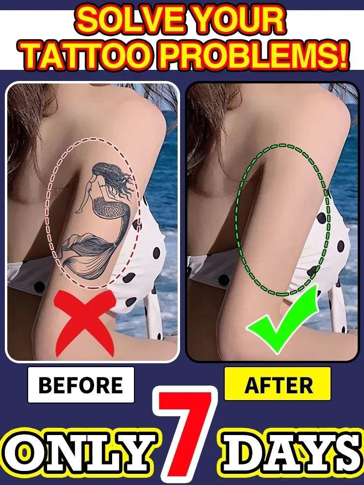 Tattoo Removal Essential Oil, Suitable for Large and Small Tattoos, Effectively Removes Permanent Tattoos
